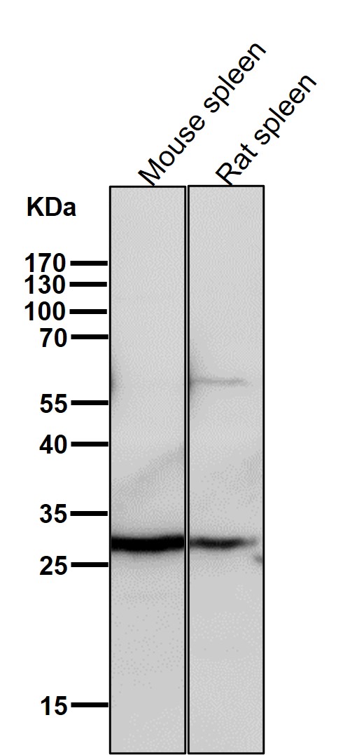 RPS3 Ab