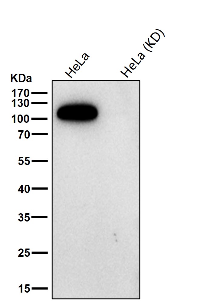 Hexokinase 1 Ab