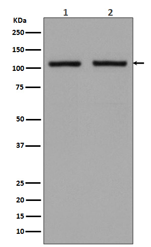 Hexokinase 1 Ab