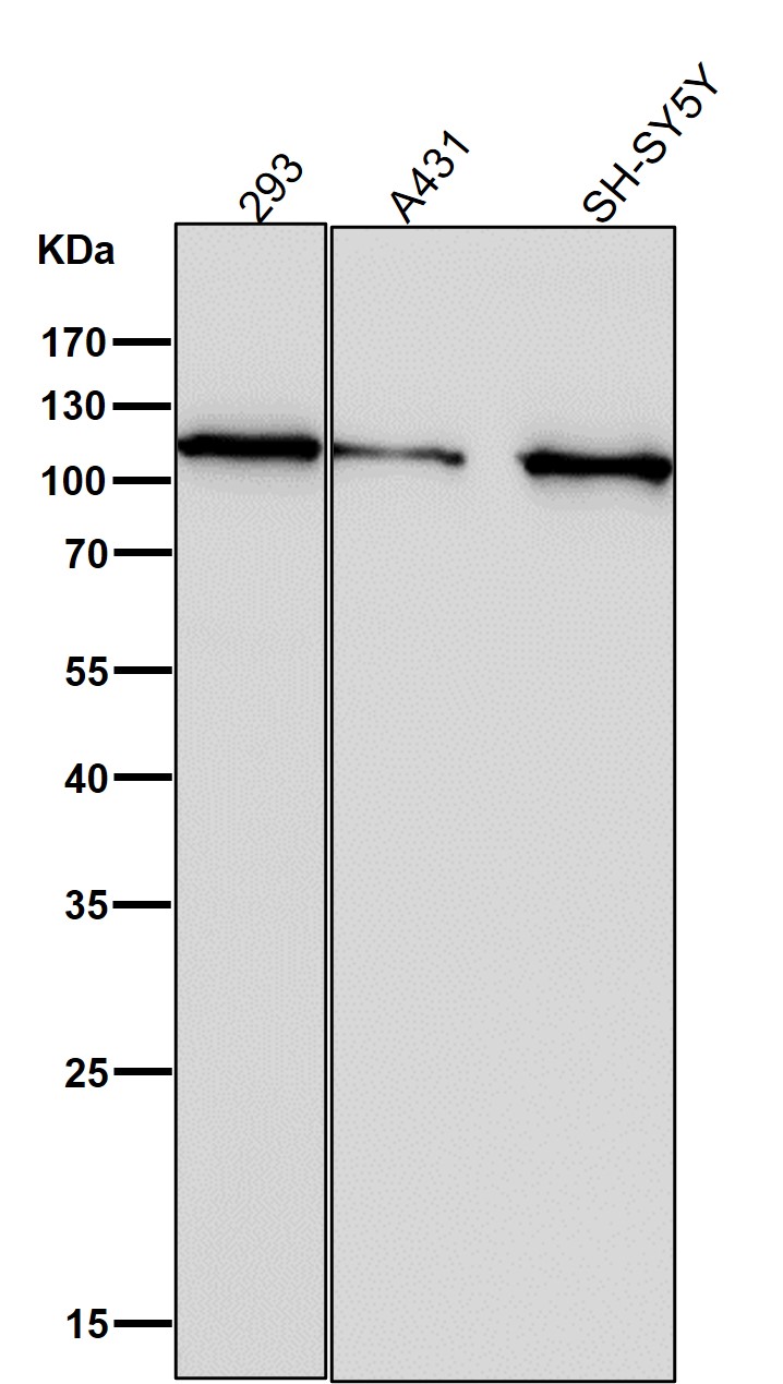 Hexokinase 1 Ab