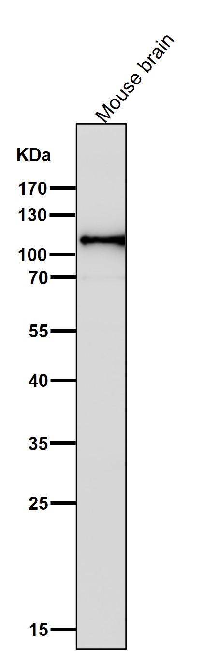 Hexokinase 1 Ab