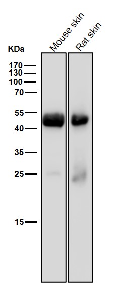 PGK1 Ab