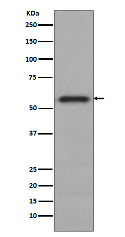 p-c Myc (S62) Ab