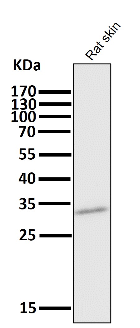 CD8 alpha Ab