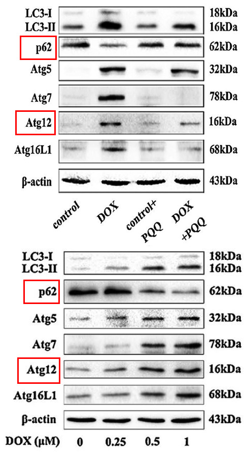 p62 SQSTM1 Ab