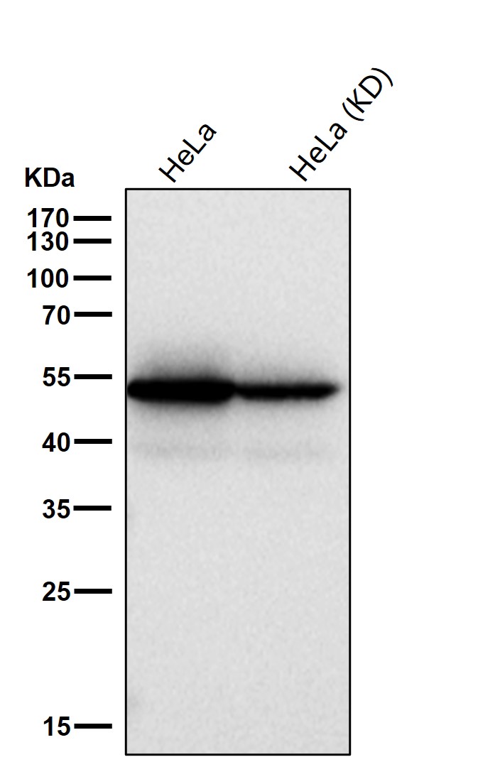 Cytokeratin 7 Ab