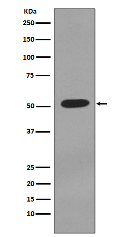 Cytokeratin 7 Ab