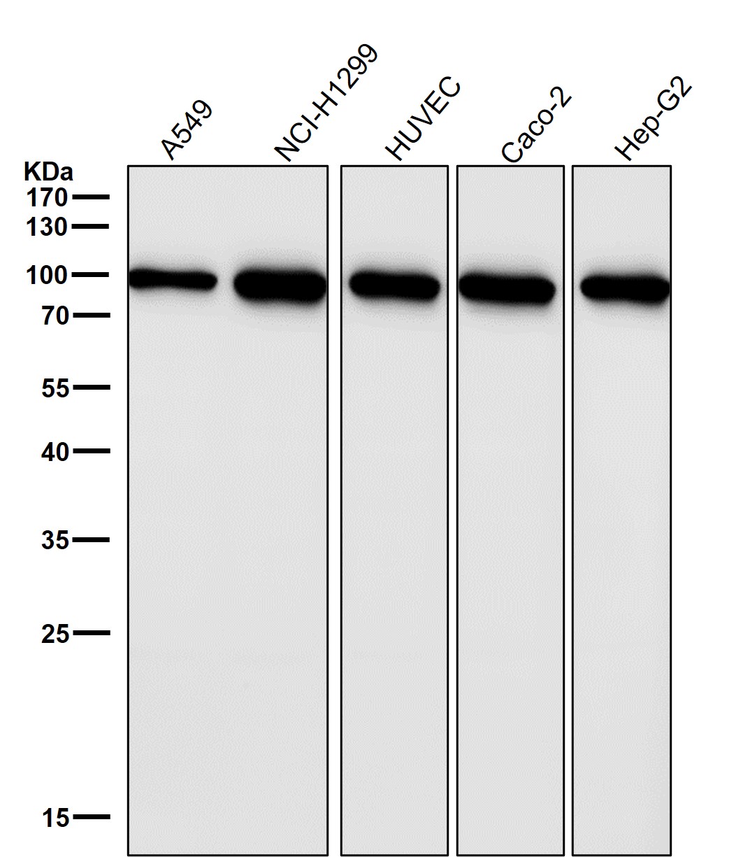 Hsp90 Ab