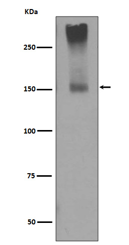 mGluR5 Ab