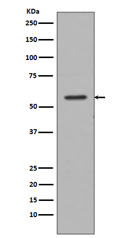 Tyrosine hydroxylase Ab