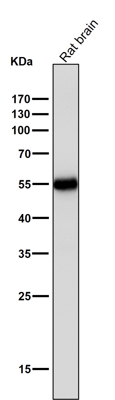 Tyrosine hydroxylase Ab