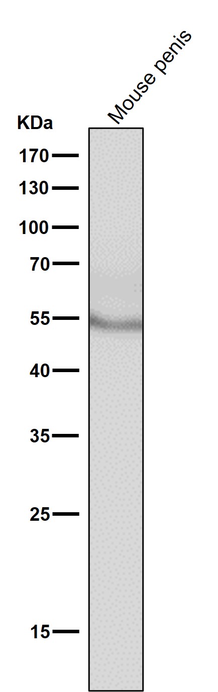 Tyrosine hydroxylase Ab