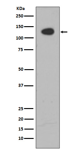 ATP citrate synthase Ab