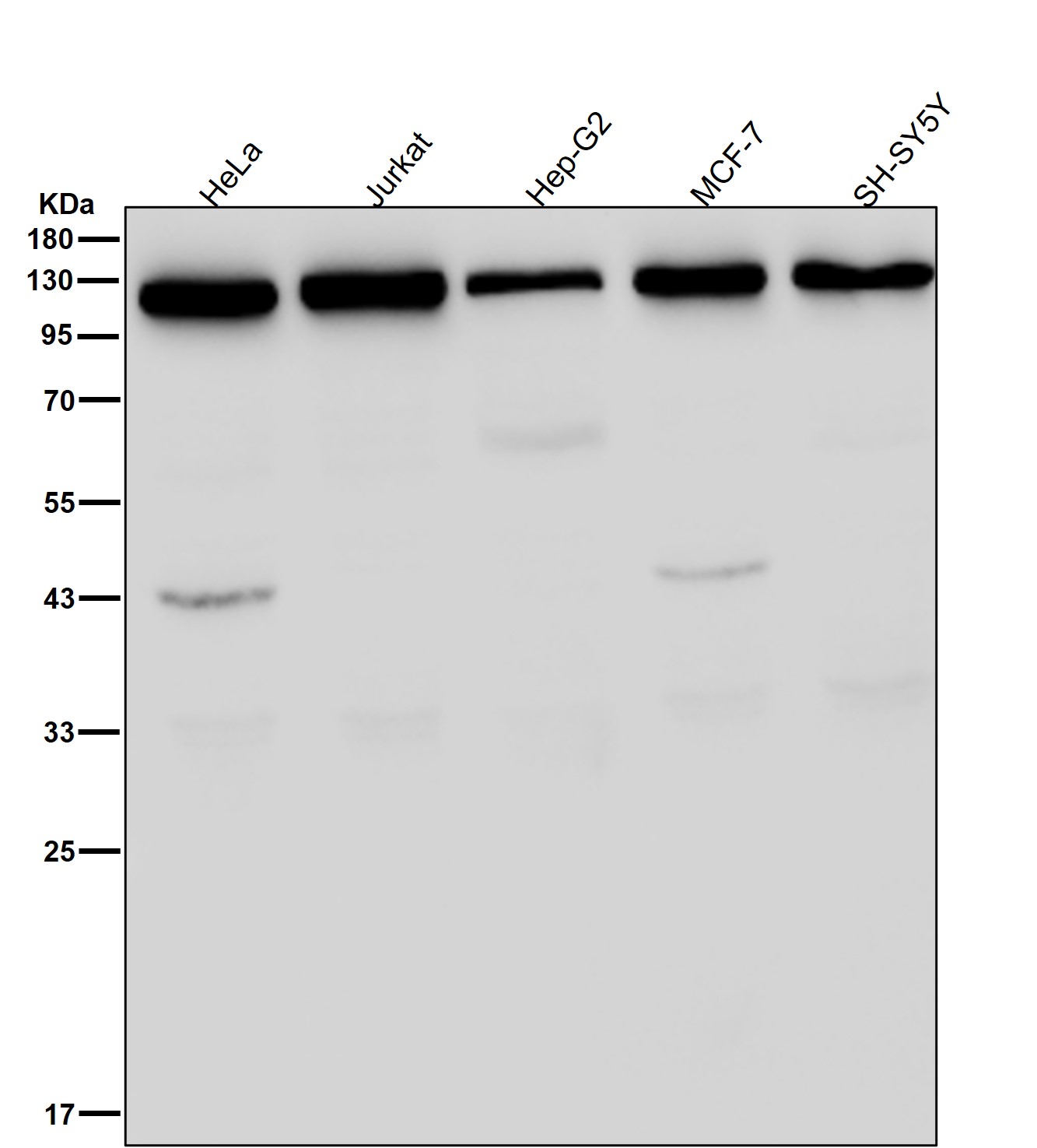 ATP citrate synthase Ab