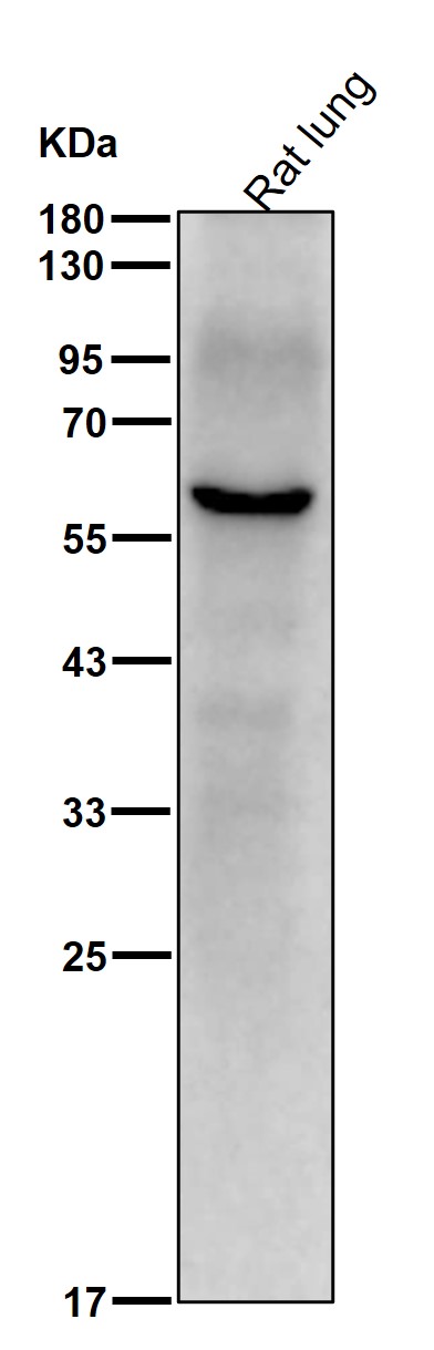 Lamin B Receptor Ab