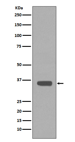 Apolipoprotein E Ab