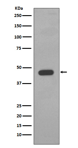 Cytokeratin 14 Ab