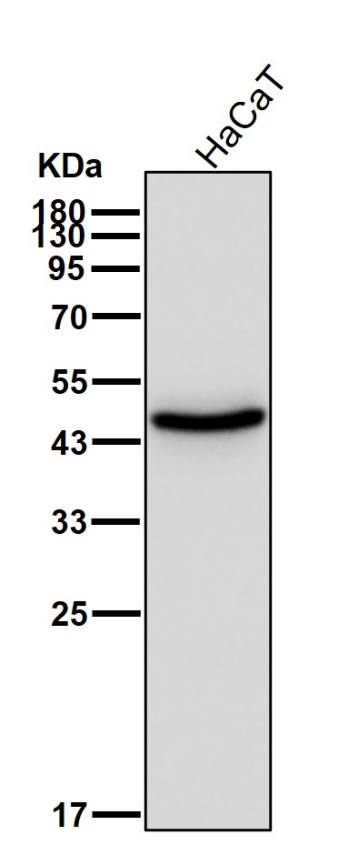 Cytokeratin 14 Ab