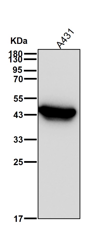 Cytokeratin 14 Ab