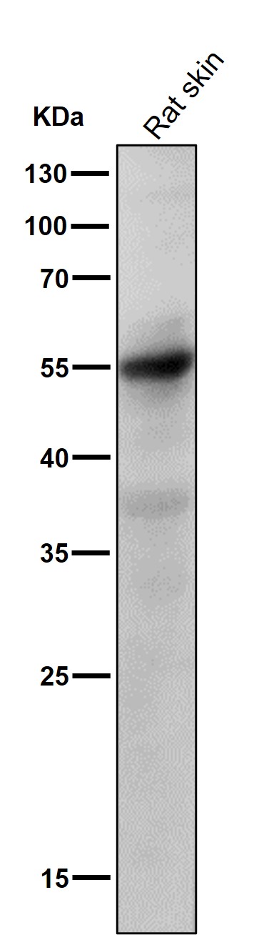 Caspase 8 Ab