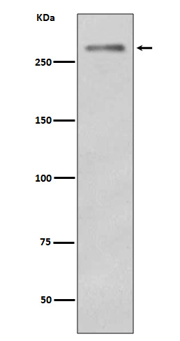 Dysferlin Ab