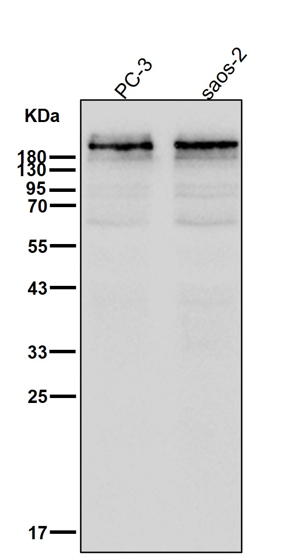 Dysferlin Ab