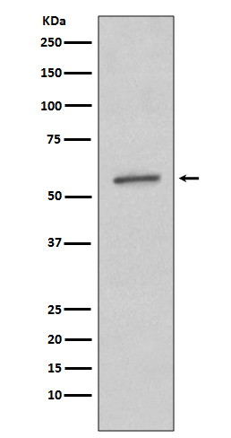 SGK1 Ab