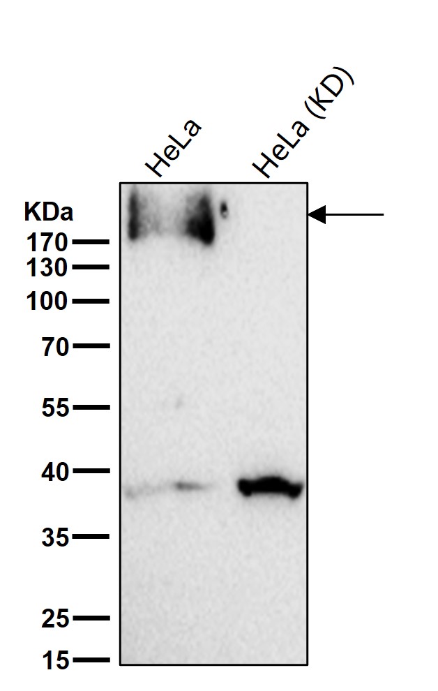 p-EGFR (Y1197) Ab