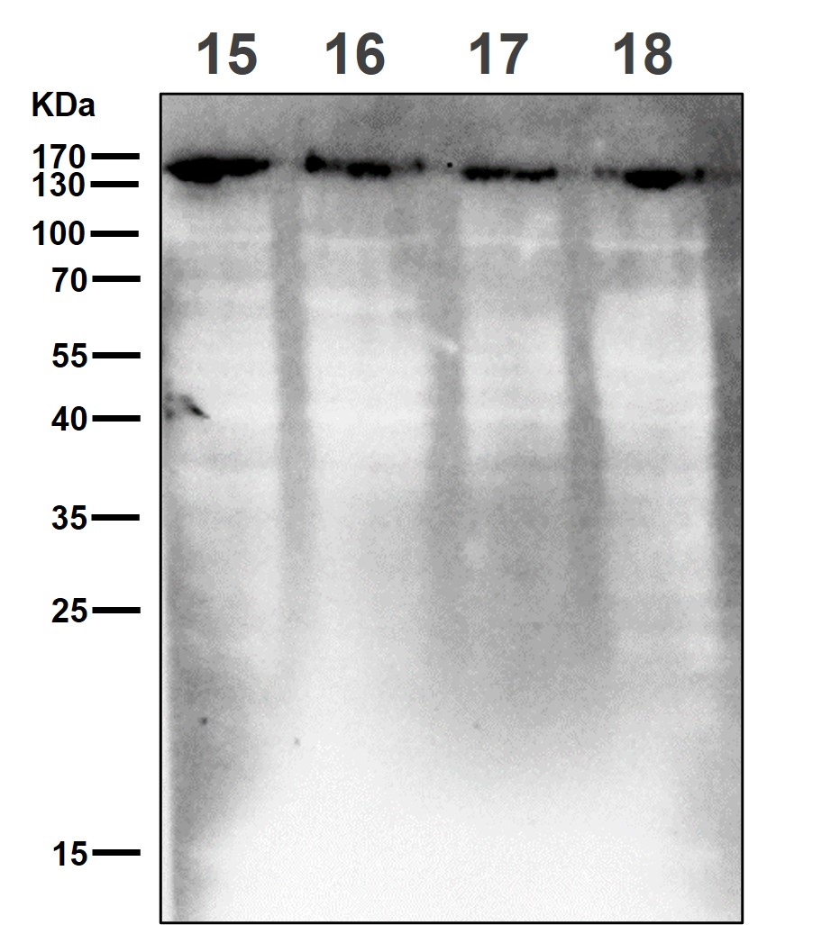 PLCG1 Ab