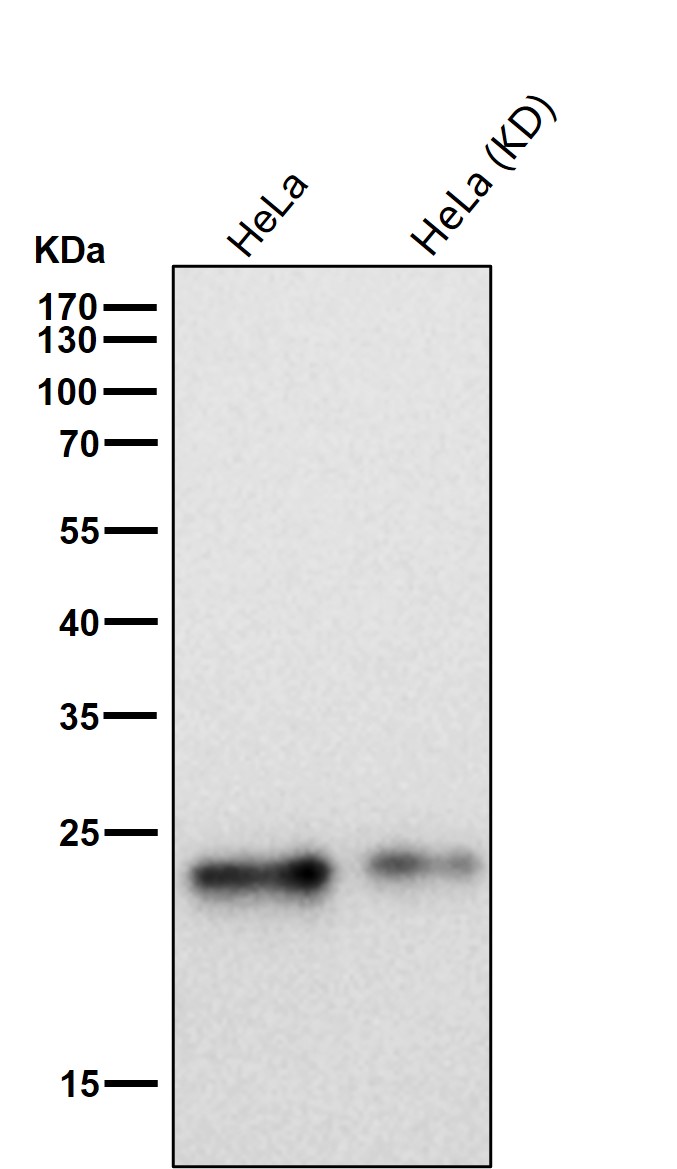 Ferritin Ab