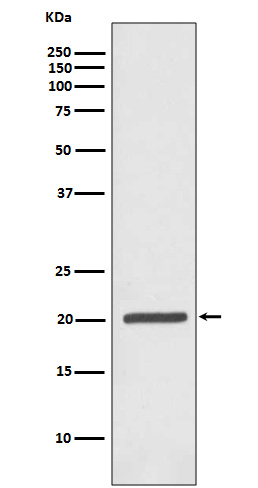 Ferritin Ab