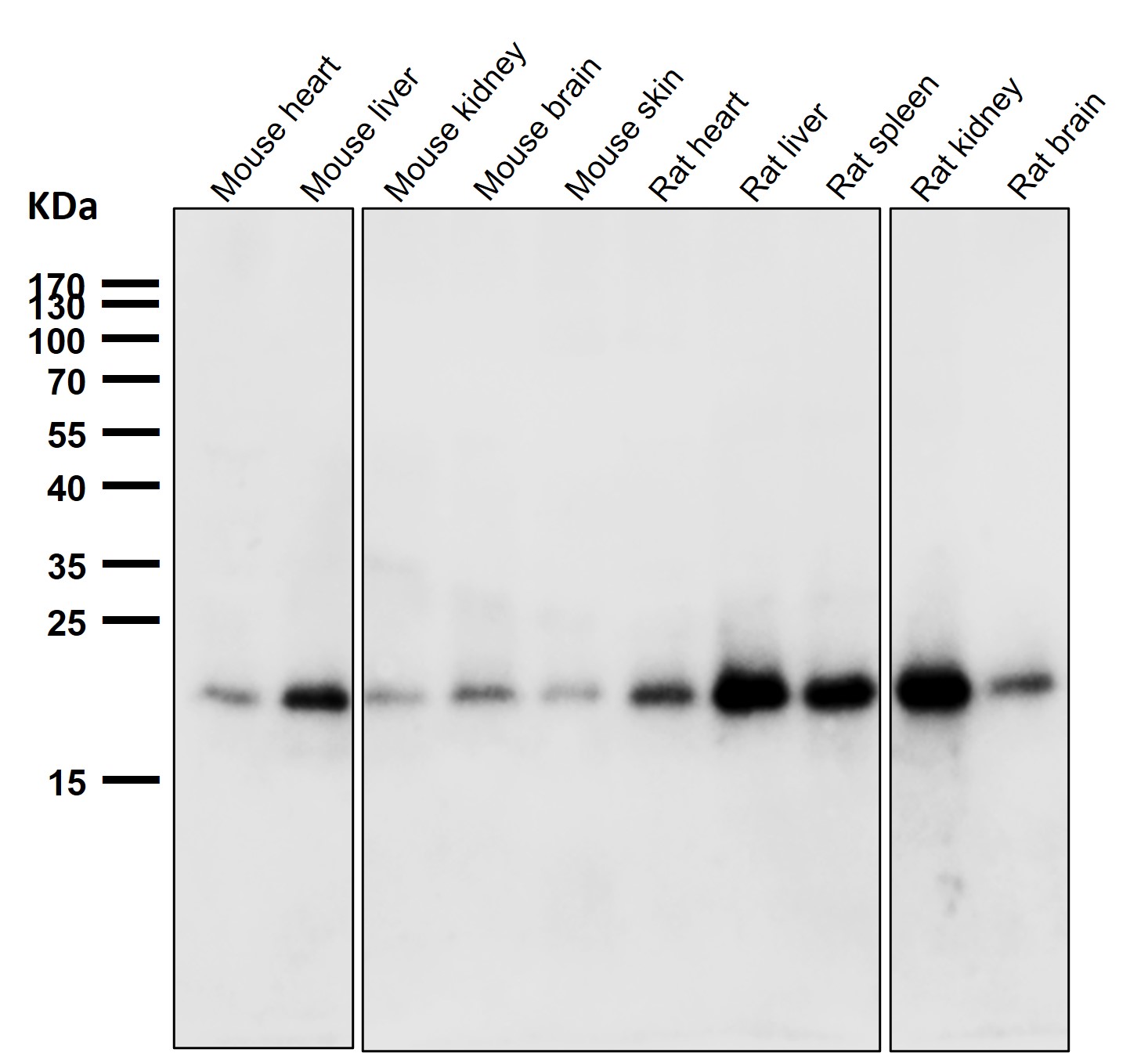 Ferritin Ab