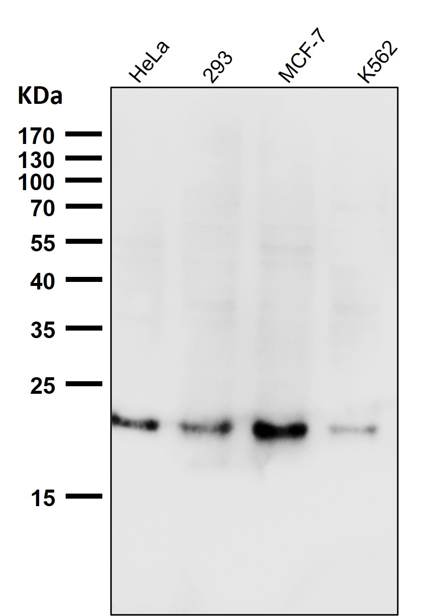 Ferritin Ab