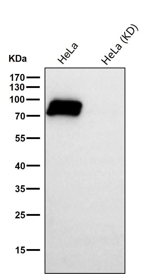 Radixin Ab