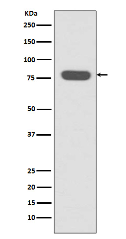 Radixin Ab