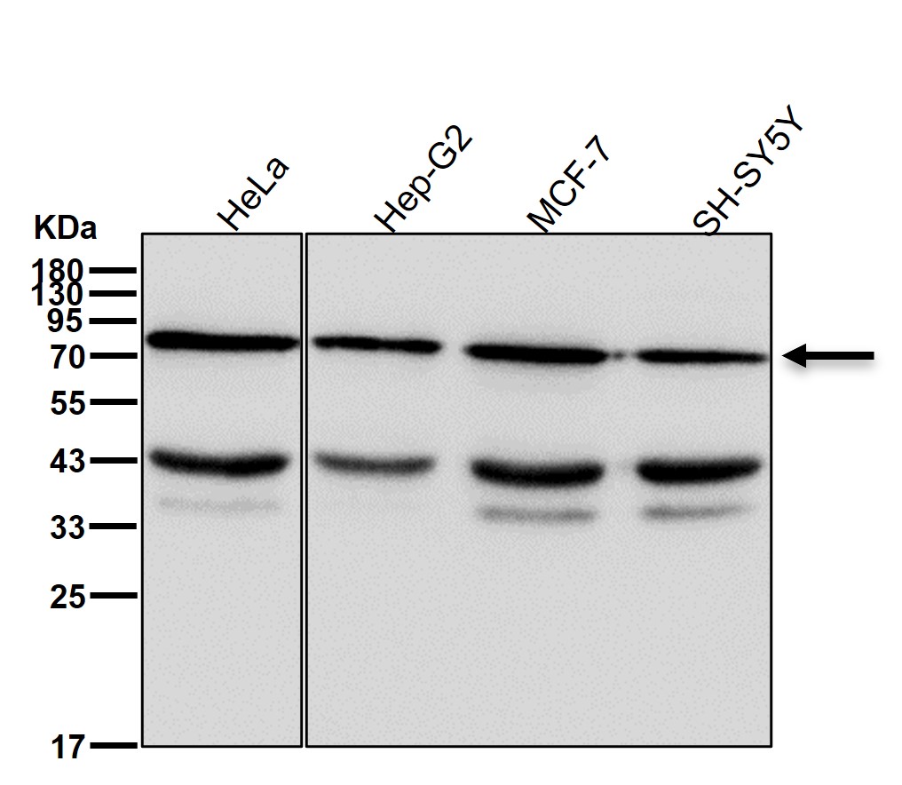 Radixin Ab