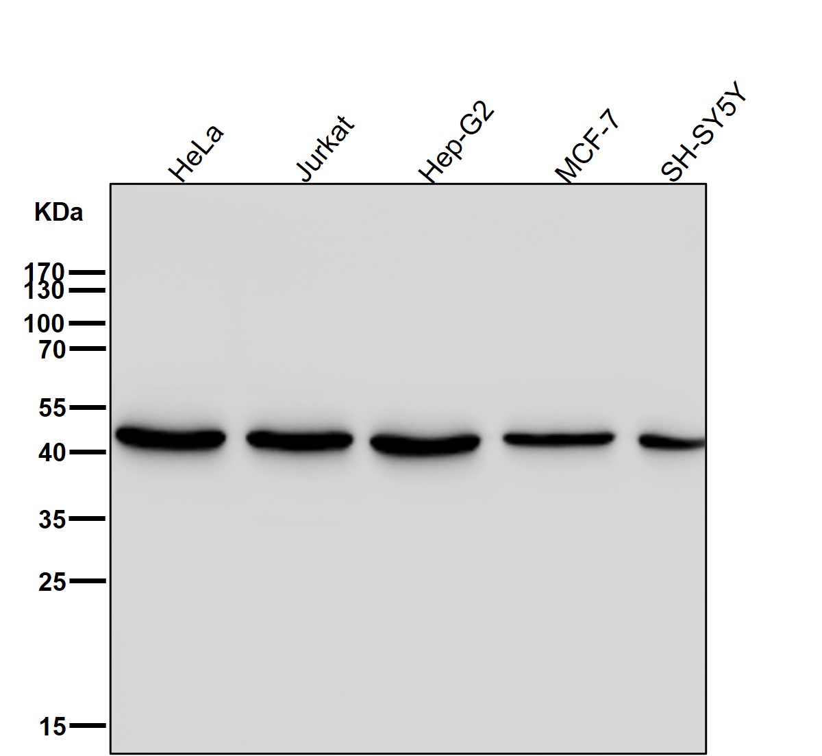 gamma Enolase Ab