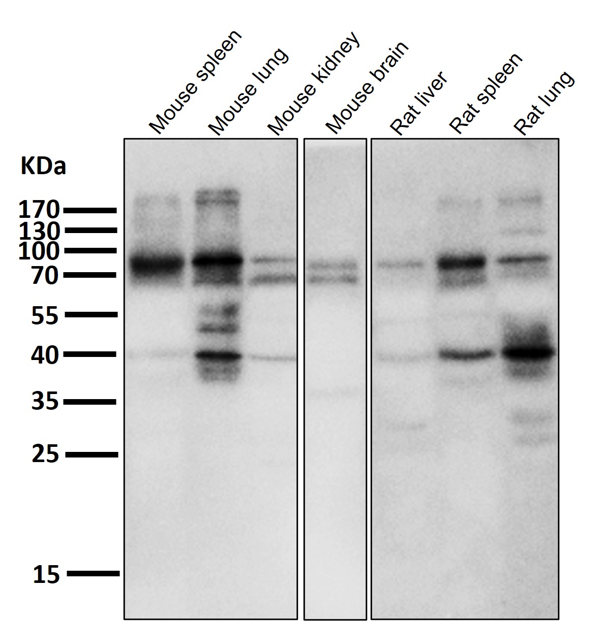 IKK alpha/beta Ab