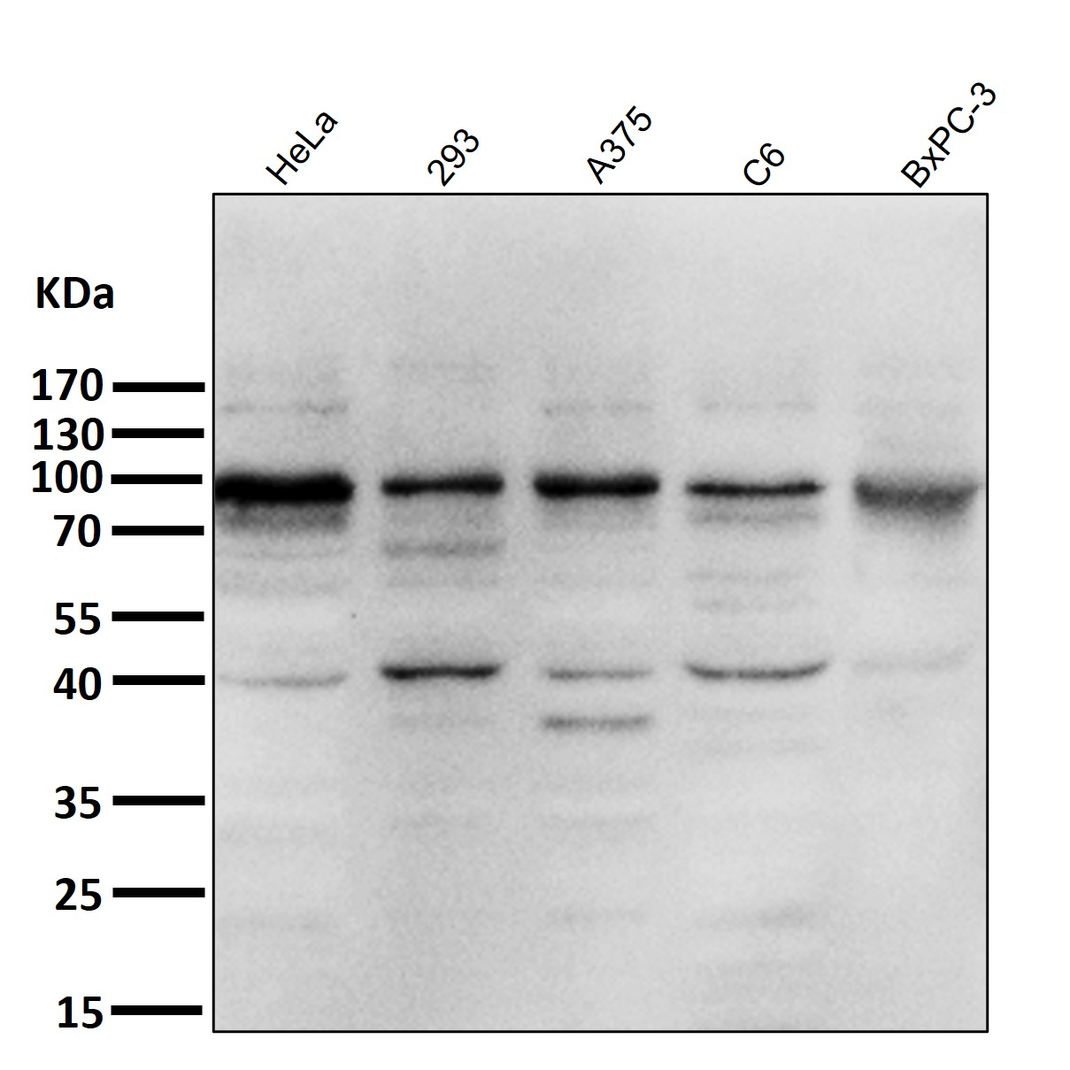 IKK alpha/beta Ab