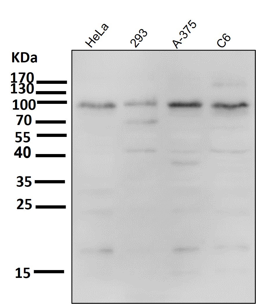 IKK alpha/beta Ab