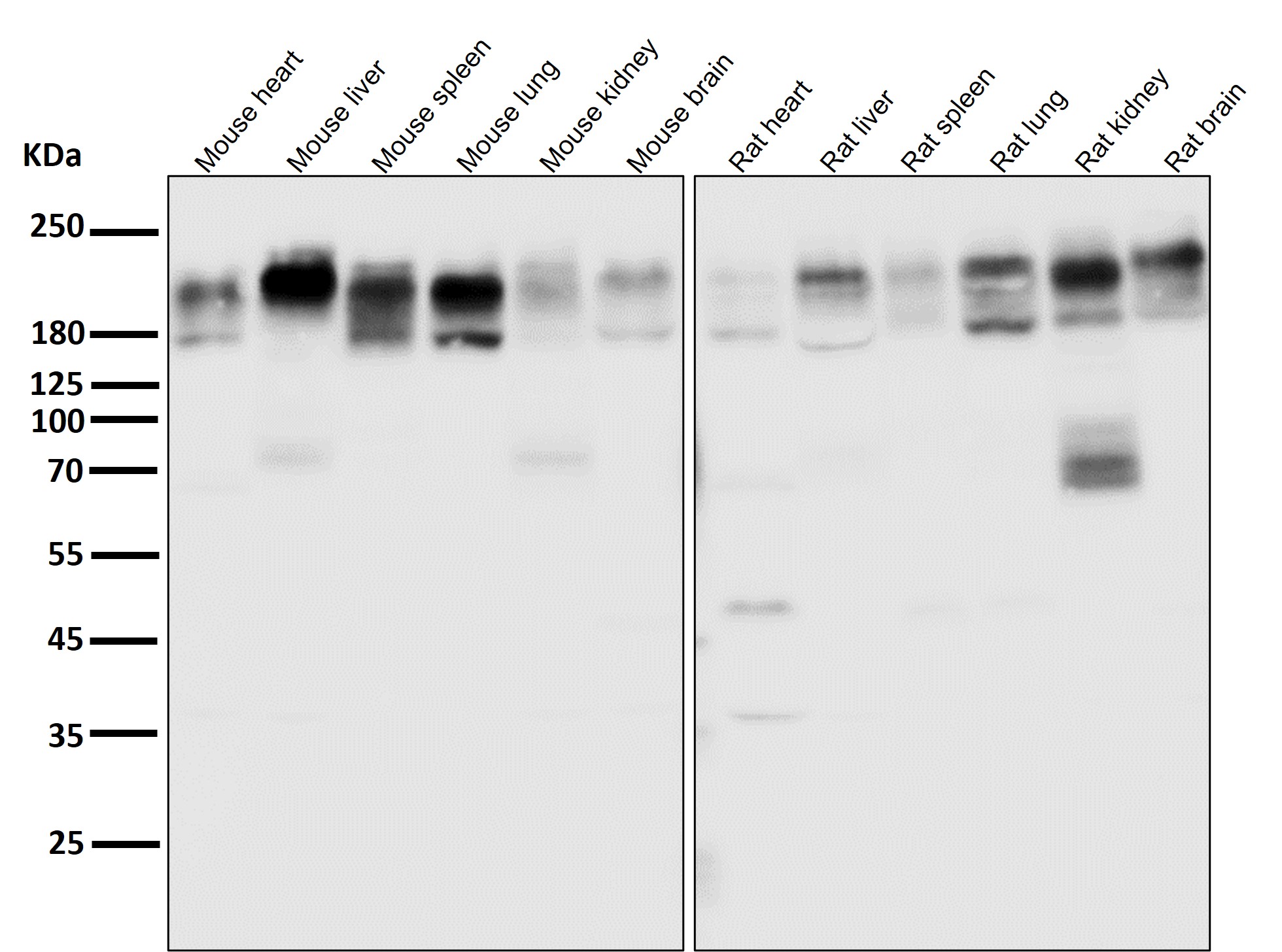 ABCB1 Ab