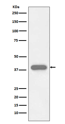 Troponin T Ab