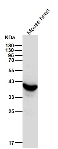 Troponin T Ab