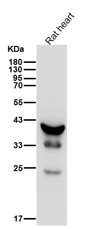 Troponin T Ab