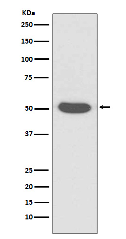 Cytokeratin 14 Ab