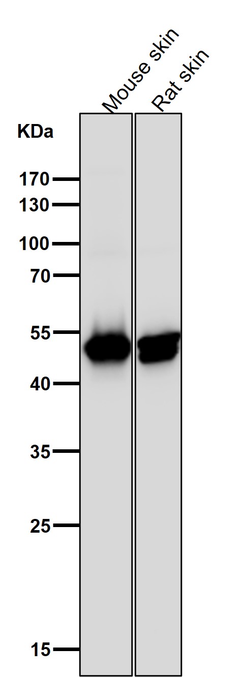 Cytokeratin 14 Ab