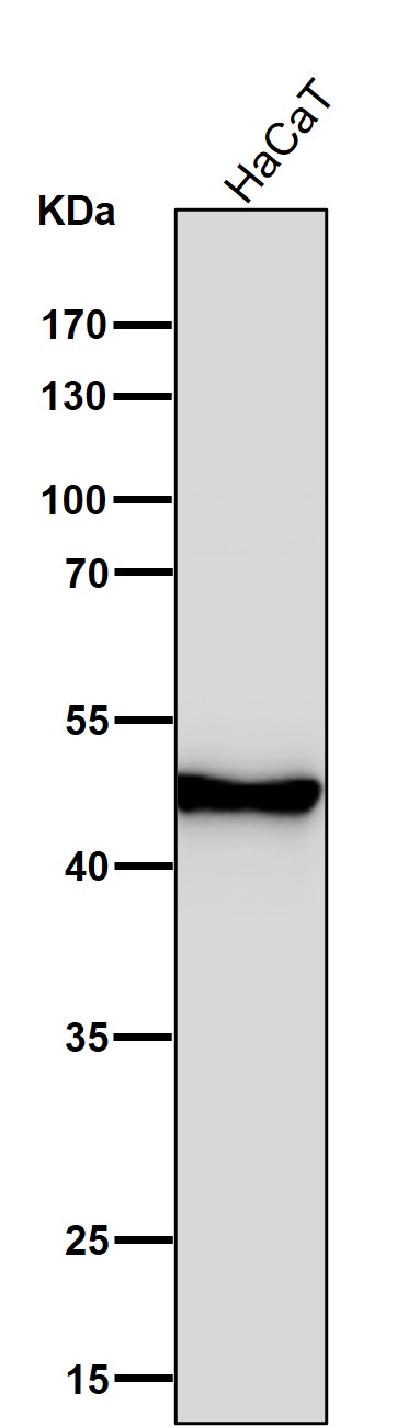 Cytokeratin 14 Ab