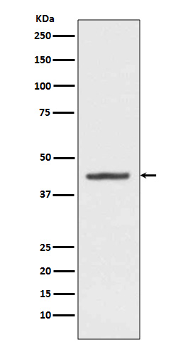 Porphobilinogen deaminase Ab