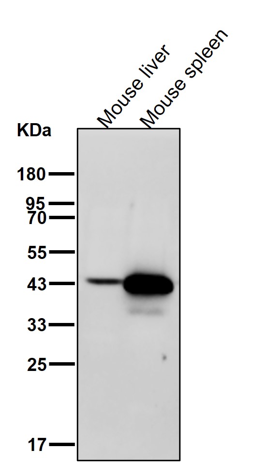 Porphobilinogen deaminase Ab