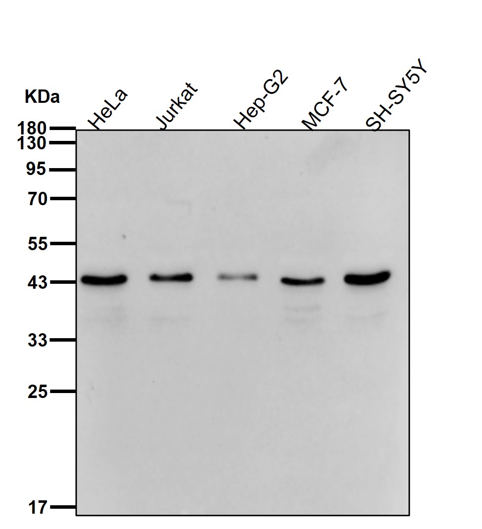 Porphobilinogen deaminase Ab